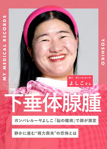 ガンバレルーヤよしこ「脳の難病」で顔が激変。静かに進む゛視力喪失゛の恐怖とは